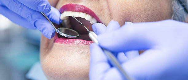 Best Emergency Dentist for Lost Fillings or Crowns in Westport, NC