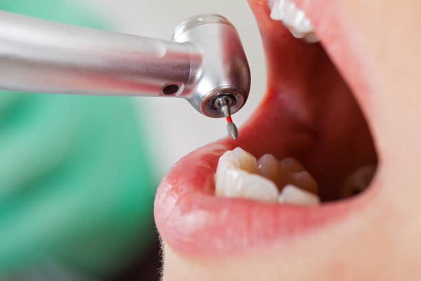 Best Emergency Dental Extractions in Westport, NC